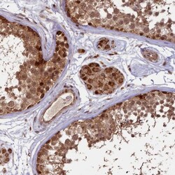 SHPRH Antibody, Novus Biologicals 0.1mL; Unlabeled:Antibodies, Polyclonal